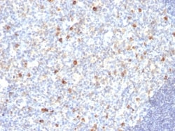 IgM Antibody (SPM188), Novus Biologicals 0.2mg; Unlabeled:Antibodies, Monoclonal